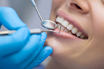 Downtown Parker Dental | Dental Fillings, Oral Cancer Screening and Dentures