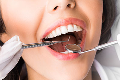 Downtown Parker Dental | Oral Exams, Veneers and ZOOM  Whitening