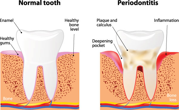 Downtown Parker Dental | Cosmetic Dentistry, Dental Cleanings and Orthodontics